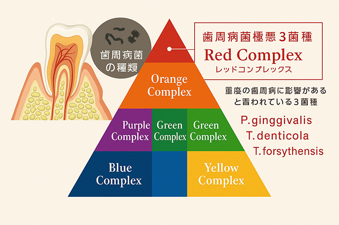 インプラント前の歯周病菌検査